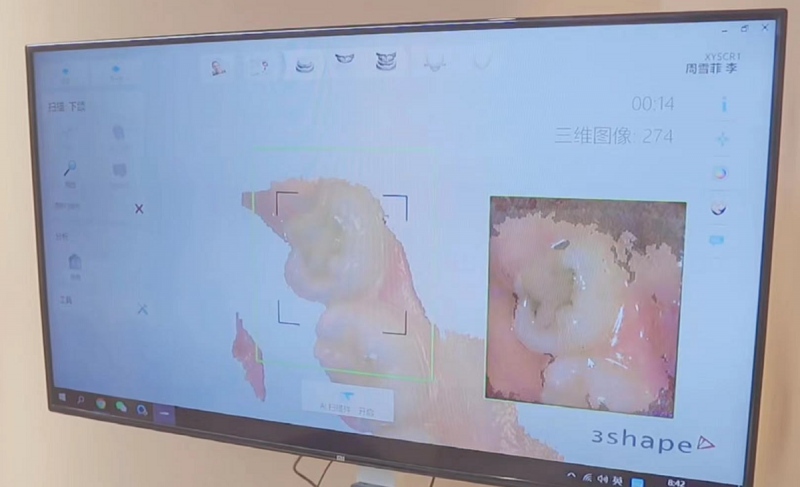 笑研所 |《快把身体还给我》中的隐藏宝藏